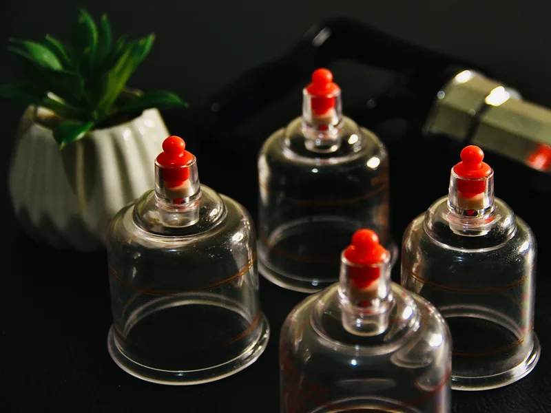 How Cupping Therapy works at HealthSource of Harvest