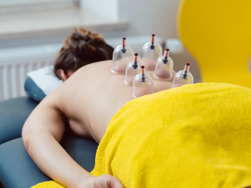 Cupping Therapy at HealthSource of Harvest in HARVEST