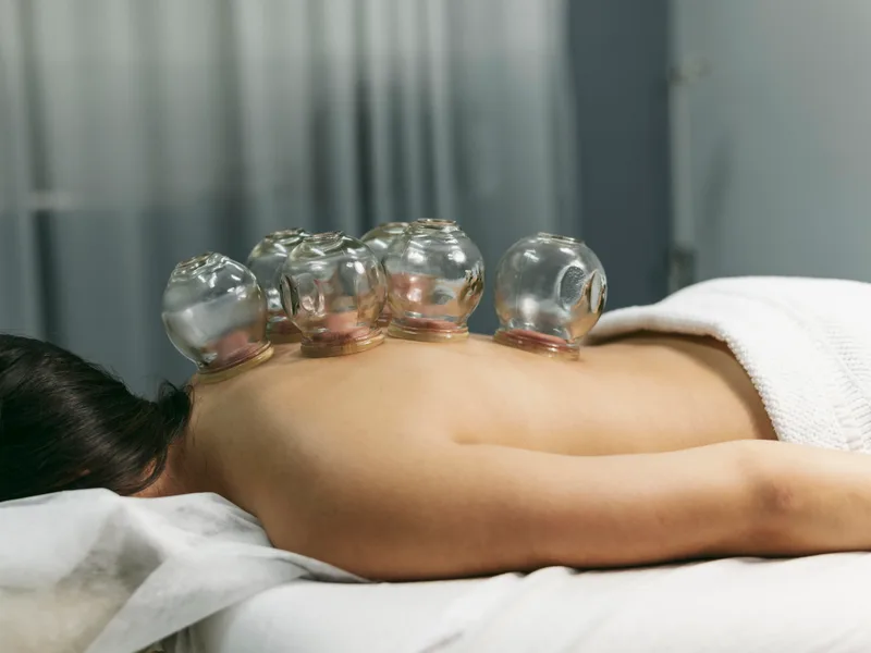 Cupping Therapy at HealthSource of Harvest in HARVEST