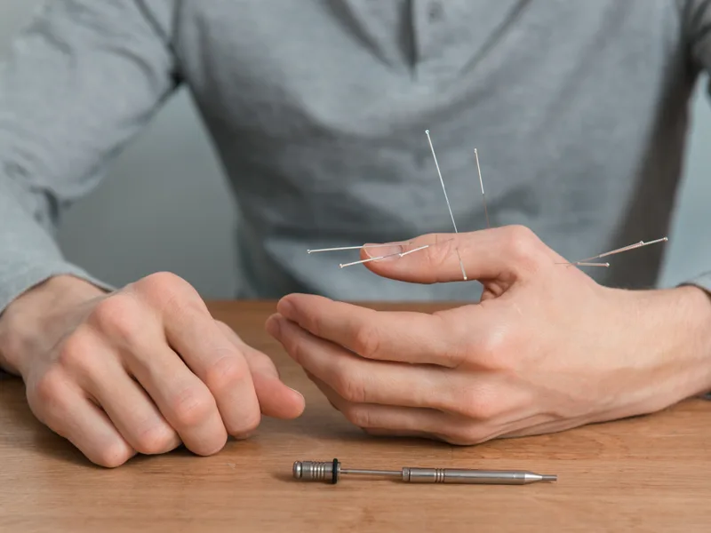 Dry Needling at HealthSource of Harvest in HARVEST