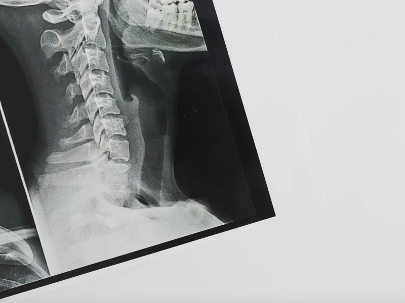 X-Rays at HealthSource of Harvest in HARVEST